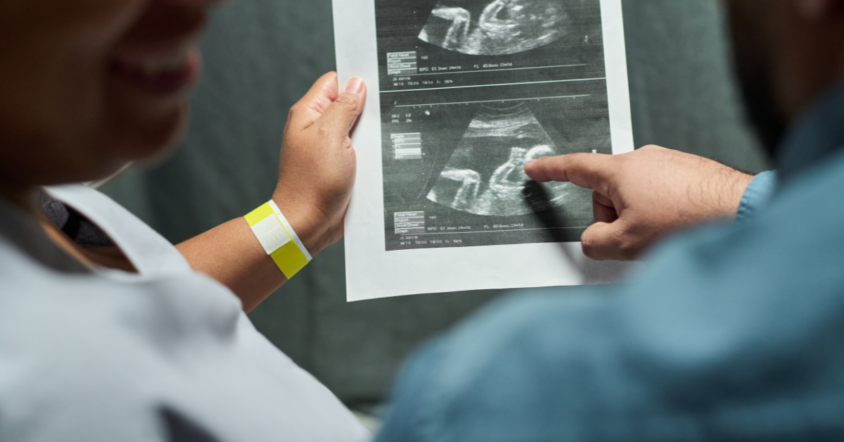 Patient undergoing a PET CT scan on the day